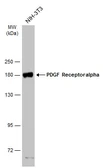 Anti-PDGF Receptor alpha antibody used in Western Blot (WB). GTX133588