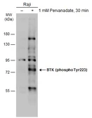 Anti-BTK (phospho Tyr223) antibody used in Western Blot (WB). GTX133591