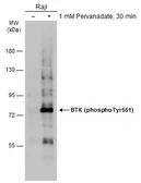 Anti-BTK (phospho Tyr551) antibody used in Western Blot (WB). GTX133592