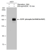 Anti-EGFR (phospho Ser1046/Ser1047) antibody used in Western Blot (WB). GTX133593