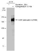 Anti-EGFR (phospho Tyr1148) antibody used in Western Blot (WB). GTX133594