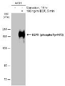 Anti-EGFR (phospho Tyr1173) antibody used in Western Blot (WB). GTX133595