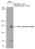 Anti-EGFR (phospho Thr669) antibody used in Western Blot (WB). GTX133596