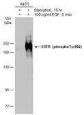 Anti-EGFR (phospho Tyr992) antibody used in Western Blot (WB). GTX133597