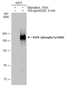 Anti-EGFR (phospho Tyr1045) antibody used in Western Blot (WB). GTX133598