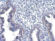 Anti-EGFR (phospho Tyr1045) antibody used in IHC (Paraffin sections) (IHC-P). GTX133598