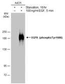 Anti-EGFR (phospho Tyr1086) antibody used in Western Blot (WB). GTX133599