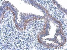Anti-EGFR (phospho Tyr1086) antibody used in IHC (Paraffin sections) (IHC-P). GTX133599