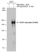 Anti-EGFR (phospho Tyr845) antibody used in Western Blot (WB). GTX133600