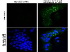 Anti-EGFR (phospho Tyr845) antibody used in Immunocytochemistry/ Immunofluorescence (ICC/IF). GTX133600
