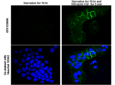 Anti-EGFR (phospho Tyr845) antibody used in Immunocytochemistry/ Immunofluorescence (ICC/IF). GTX133600
