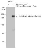 Anti-Her2 / ErbB2 (phospho Tyr1196) antibody used in Western Blot (WB). GTX133602