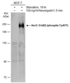 Anti-Her2 / ErbB2 (phospho Tyr877) antibody used in Western Blot (WB). GTX133605