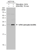 Anti-eIF4E (phospho Ser209) antibody used in Western Blot (WB). GTX133606