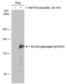 Anti-PLCG2 (phospho Tyr1217) antibody used in Western Blot (WB). GTX133610