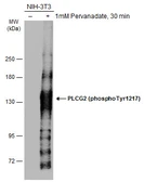 Anti-PLCG2 (phospho Tyr1217) antibody used in Western Blot (WB). GTX133610