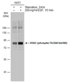 Anti-RSK3 (phospho Thr356/Ser360) antibody used in Western Blot (WB). GTX133613