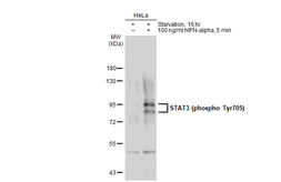 Anti-STAT3 (phospho Tyr705) antibody used in Western Blot (WB). GTX133615