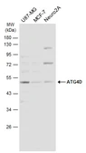Anti-ATG4D antibody used in Western Blot (WB). GTX133617