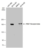 Anti-PDGF Receptor beta antibody used in Western Blot (WB). GTX133618
