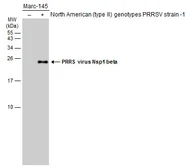 Anti-PRRS virus Nsp1 beta antibody used in Western Blot (WB). GTX133696