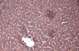 Anti-PP2A alpha + PP2A beta antibody used in IHC (Paraffin sections) (IHC-P). GTX133709