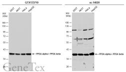 Anti-PP2A alpha + PP2A beta antibody used in Western Blot (WB). GTX133710