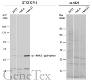 Anti-NOX2 / gp91phox antibody used in Western Blot (WB). GTX133715