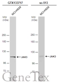 Anti-JAK3 antibody used in Western Blot (WB). GTX133717