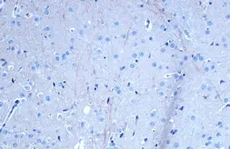 Anti-TrkB antibody used in IHC (Paraffin sections) (IHC-P). GTX133722