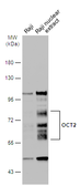Anti-OCT2 antibody used in Western Blot (WB). GTX133723