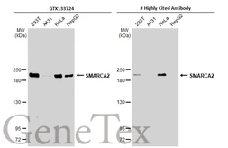 Anti-SMARCA2 antibody used in Western Blot (WB). GTX133724