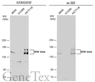 Anti-RON beta antibody used in Western Blot (WB). GTX133727
