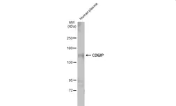 Anti-CD62P antibody used in Western Blot (WB). GTX133729