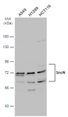 Anti-SnoN antibody used in Western Blot (WB). GTX133735