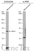Anti-DLL1 antibody used in Western Blot (WB). GTX133745