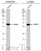 Anti-SPARC antibody used in Western Blot (WB). GTX133747