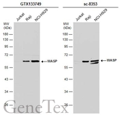 Anti-WASP antibody used in Western Blot (WB). GTX133749
