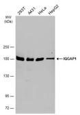 Anti-IQGAP1 antibody used in Western Blot (WB). GTX133750