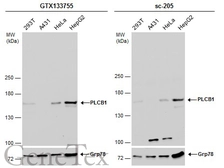 Anti-PLCB1 antibody used in Western Blot (WB). GTX133755