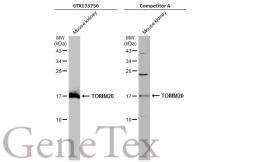 Anti-TOMM20 antibody used in Western Blot (WB). GTX133756