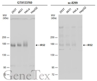 Anti-IRS2 antibody used in Western Blot (WB). GTX133760