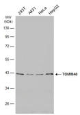 Anti-TOMM40 antibody used in Western Blot (WB). GTX133772
