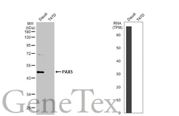 Anti-PAX5 antibody used in Western Blot (WB). GTX133777