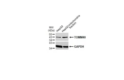 Anti-TOMM40 antibody used in Western Blot (WB). GTX133780