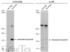 Anti-Adenylate cyclase 5/6 antibody used in Western Blot (WB). GTX133788