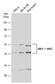 Anti-JNK1 + JNK2 antibody used in Western Blot (WB). GTX133806