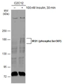 Anti-IRS1 (phospho Ser307) antibody used in Western Blot (WB). GTX133848