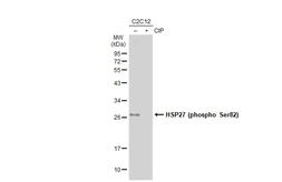 Anti-HSP27 (phospho Ser82) antibody used in Western Blot (WB). GTX133850