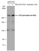Anti-ATR (phospho Ser428) antibody used in Western Blot (WB). GTX133852